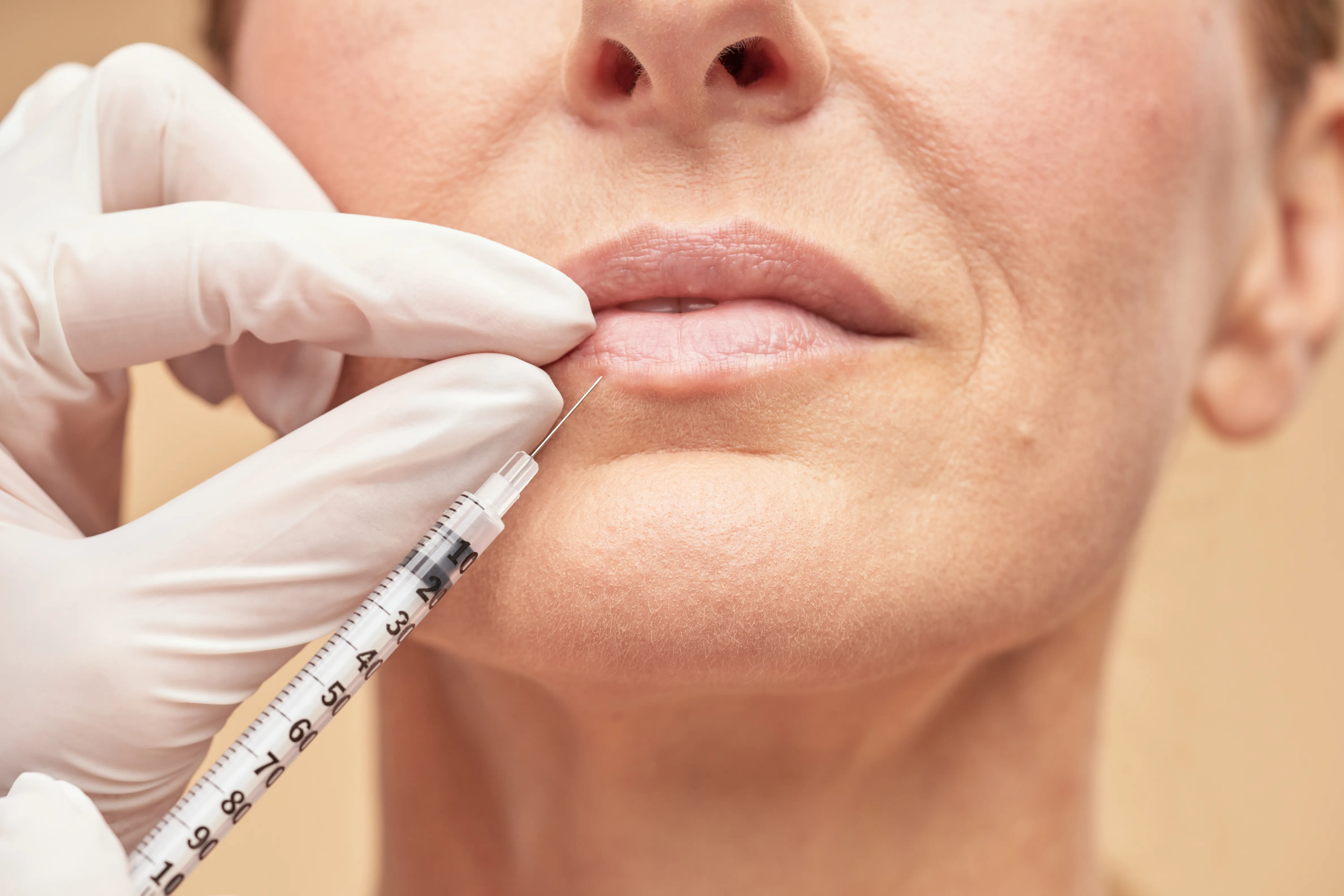Bioestimulador facial